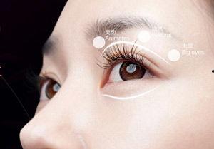 埋线双眼皮女明星,揭秘埋线双眼皮女星的美丽秘诀